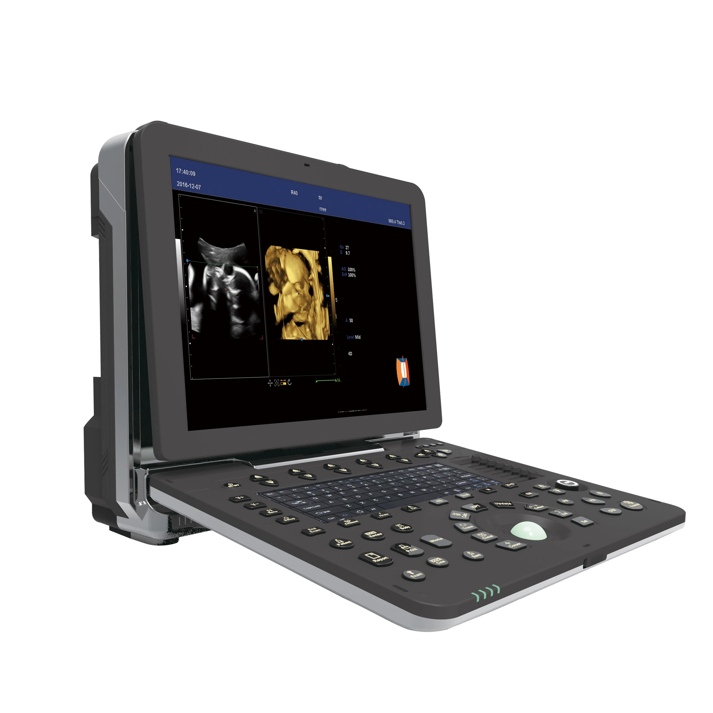 Digital Notebook Ultrasound Scanner (AM-2018)