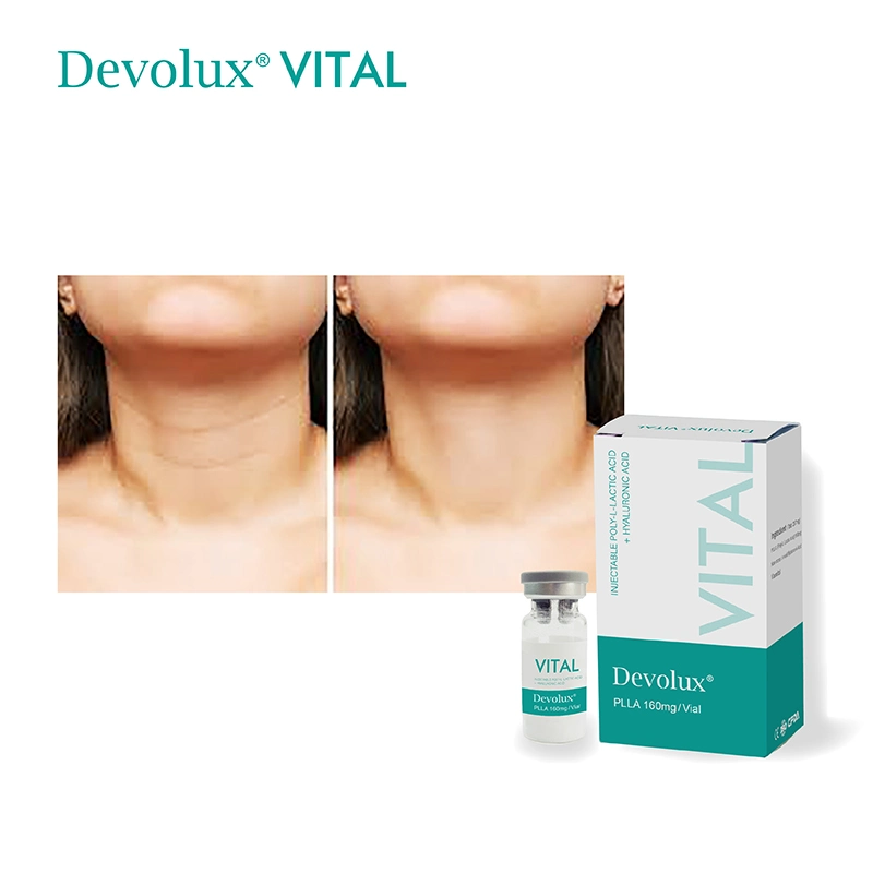 Devolux Vital Reborn PLLA Acido Polilactico Poly L Milchsäure Face Lifting Filler für Wangeneinspritzung