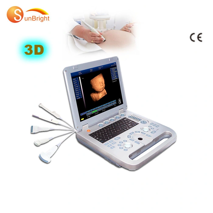 Full Digital Medical Ultrasound 3D Color USG Device Equipment Factory