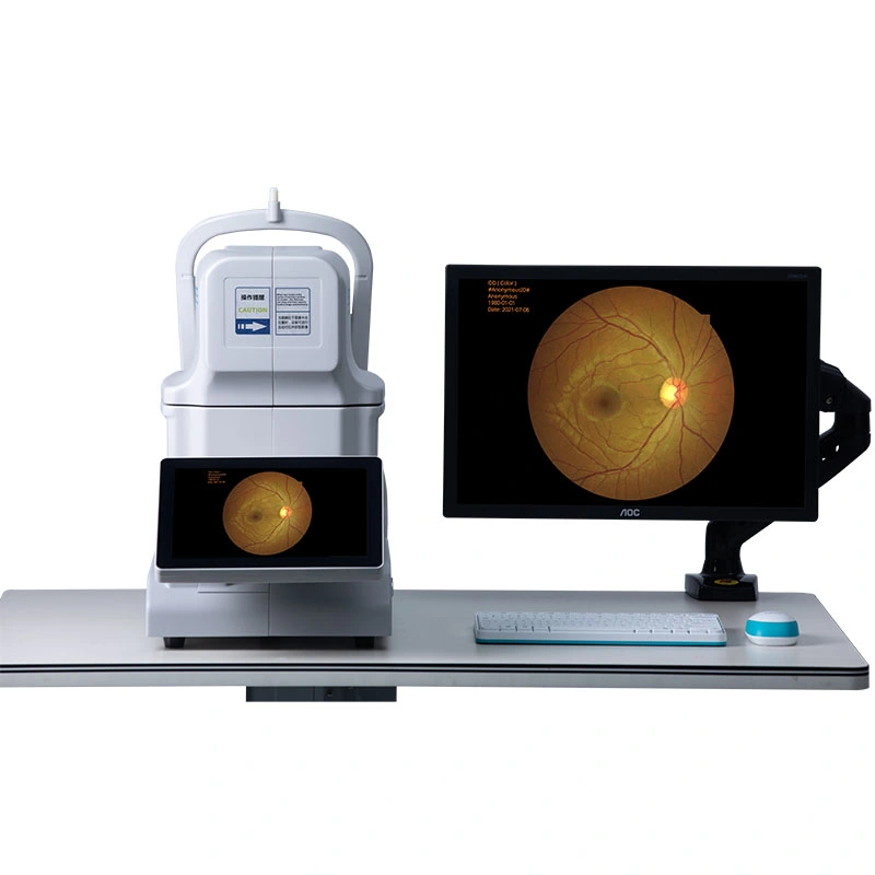 Ophthalmology Automatic Eye camera Retinal Fundus Camera