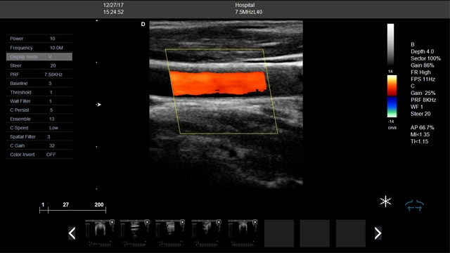 Hc-A014A Good Price 4D Color Ultrasound Medical Double Screen 4D Trolley Color Doppler Ultrasound Equipment Scanner Machine