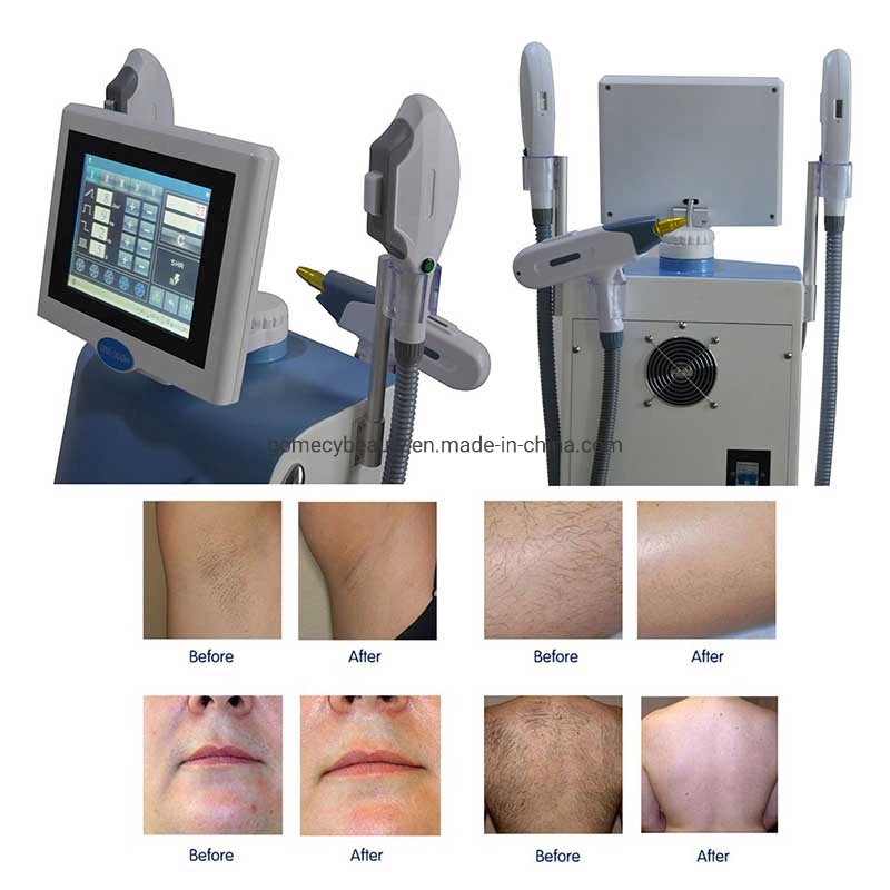 E-Light IPL RF RH ND tatouage de laser YAG Enlèvement Enlèvement de cheveux de rajeunissement de la peau de la machine de beauté