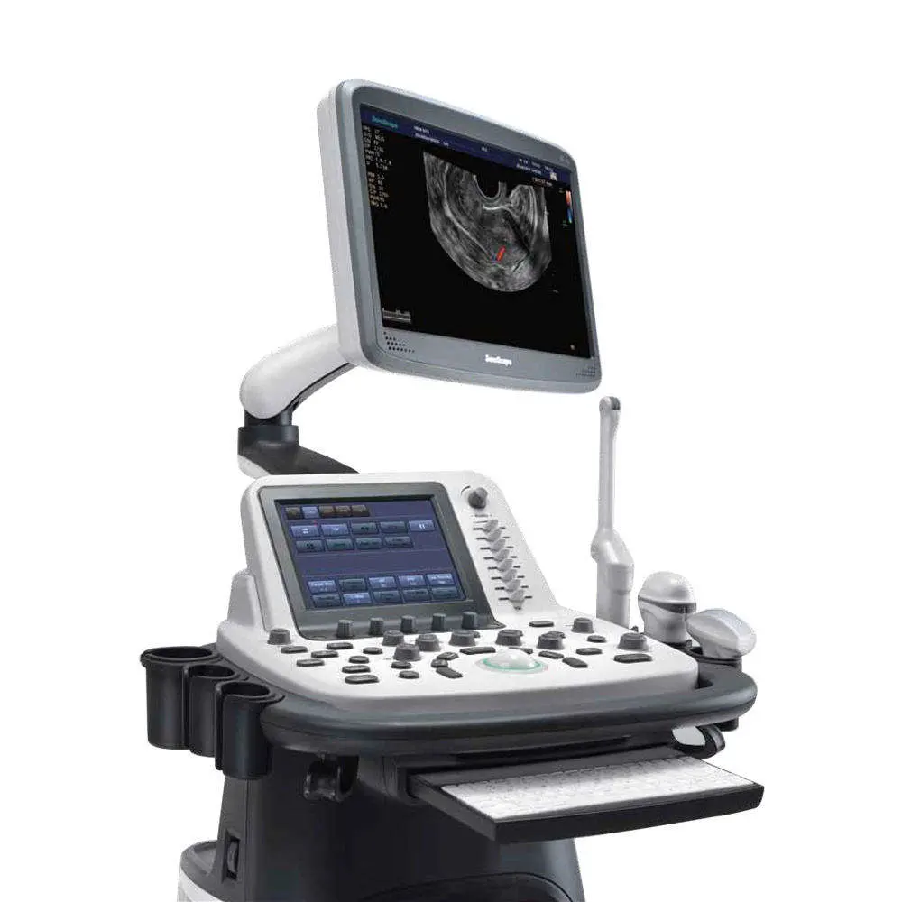 Ob/Gyn Sonoscape Trolley Type Ultrasonic 3D 4D Color Doppler Ultrasound Scanner