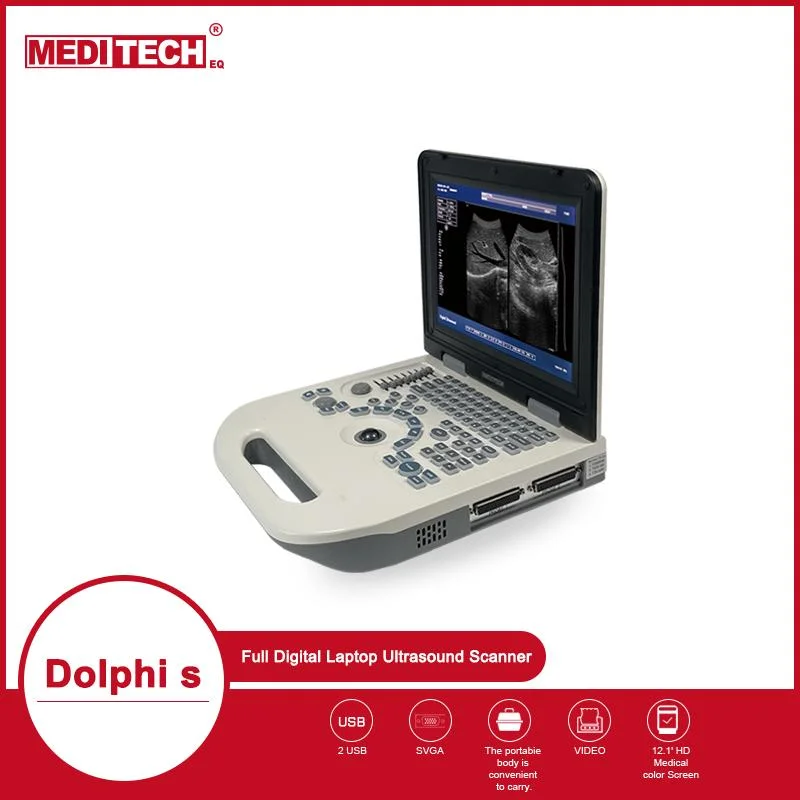 Dolphi-S New Full Digital B/W Ultrasound Scanner