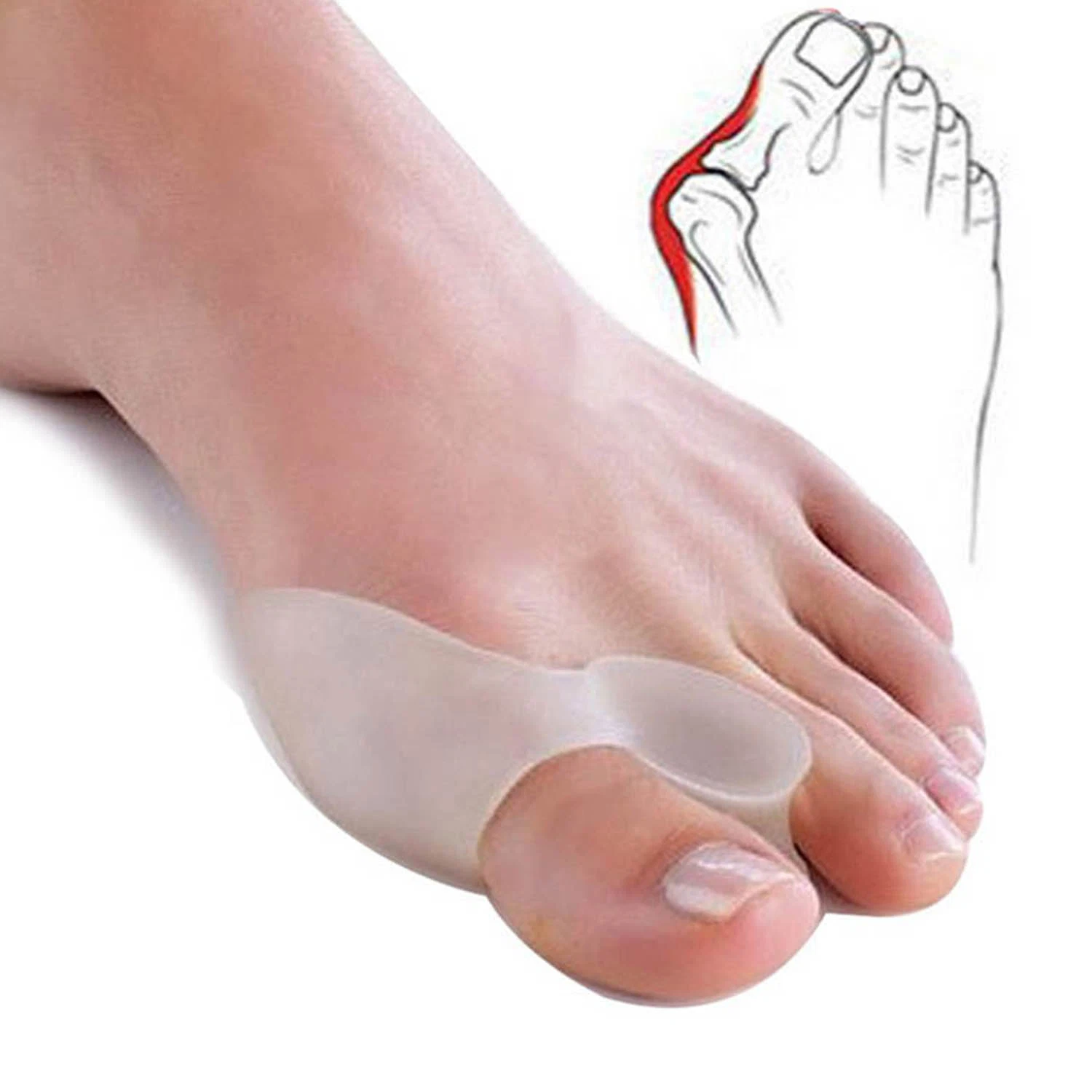 Колесико с накаткой Valgus прибора сбросить Hallux valgus ногу боль и успокоить боль Bunions