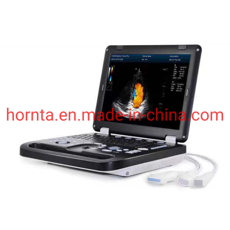 Dcu50 Color Doppler B-Ultrasound for Pig Cattle Horse Camel