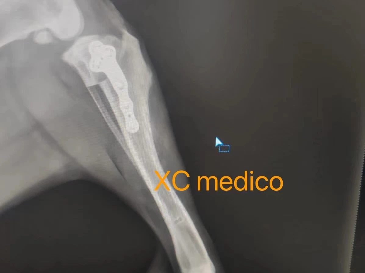 Implante cirúrgico e instrumentos veterinários Tplo o parafuso de travamento e placas