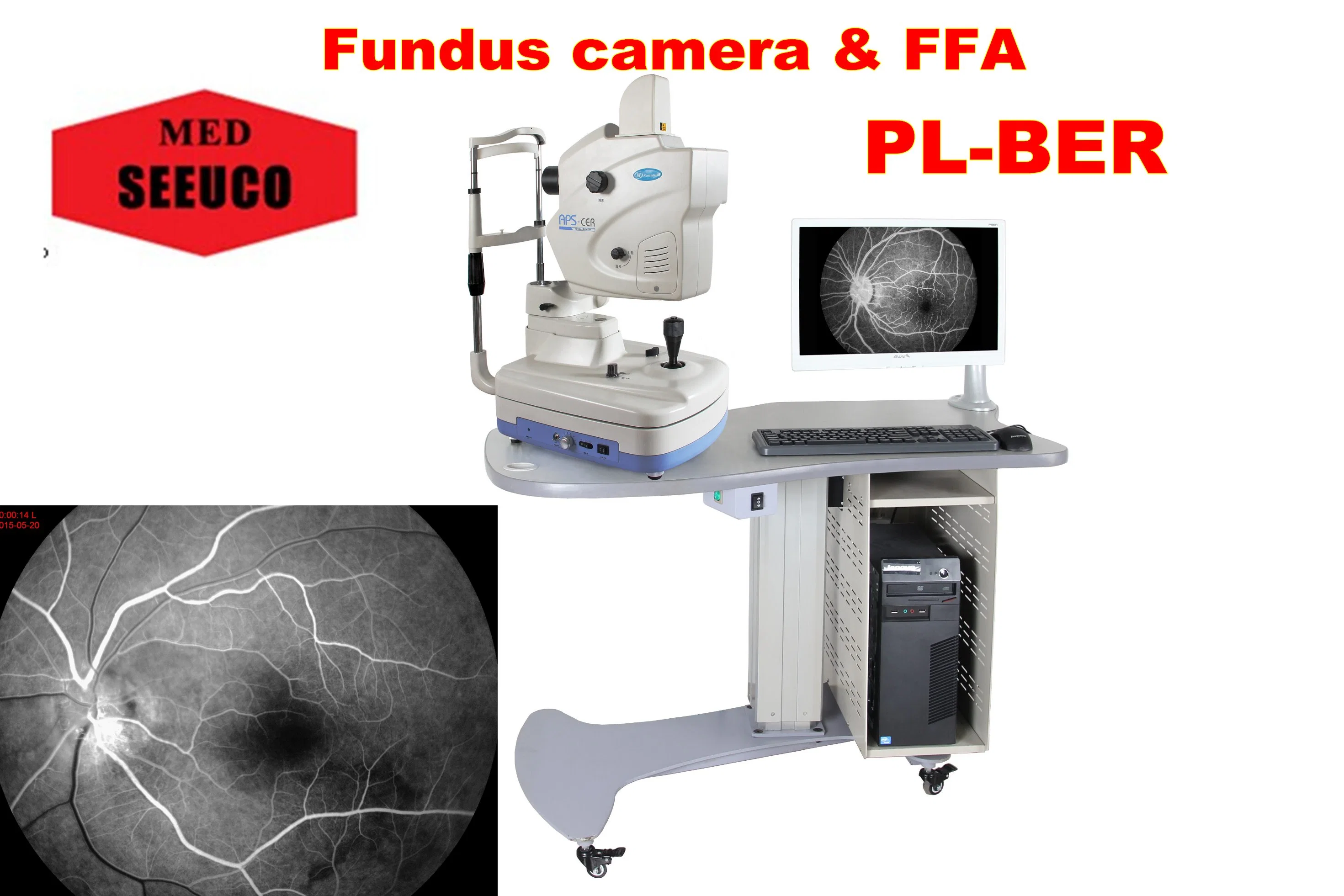 Medical Ophthalmology Fundus Camera Ffa Model Auto Focus Function PT-Aps-Ber, Model B