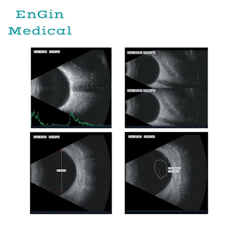 Ophthalmic Veterinary Ultrasound Scanner a/B Scanner ABS-300 Ab Scan Testing Equipment Ophthalmology Device Biometry Eye Scanner