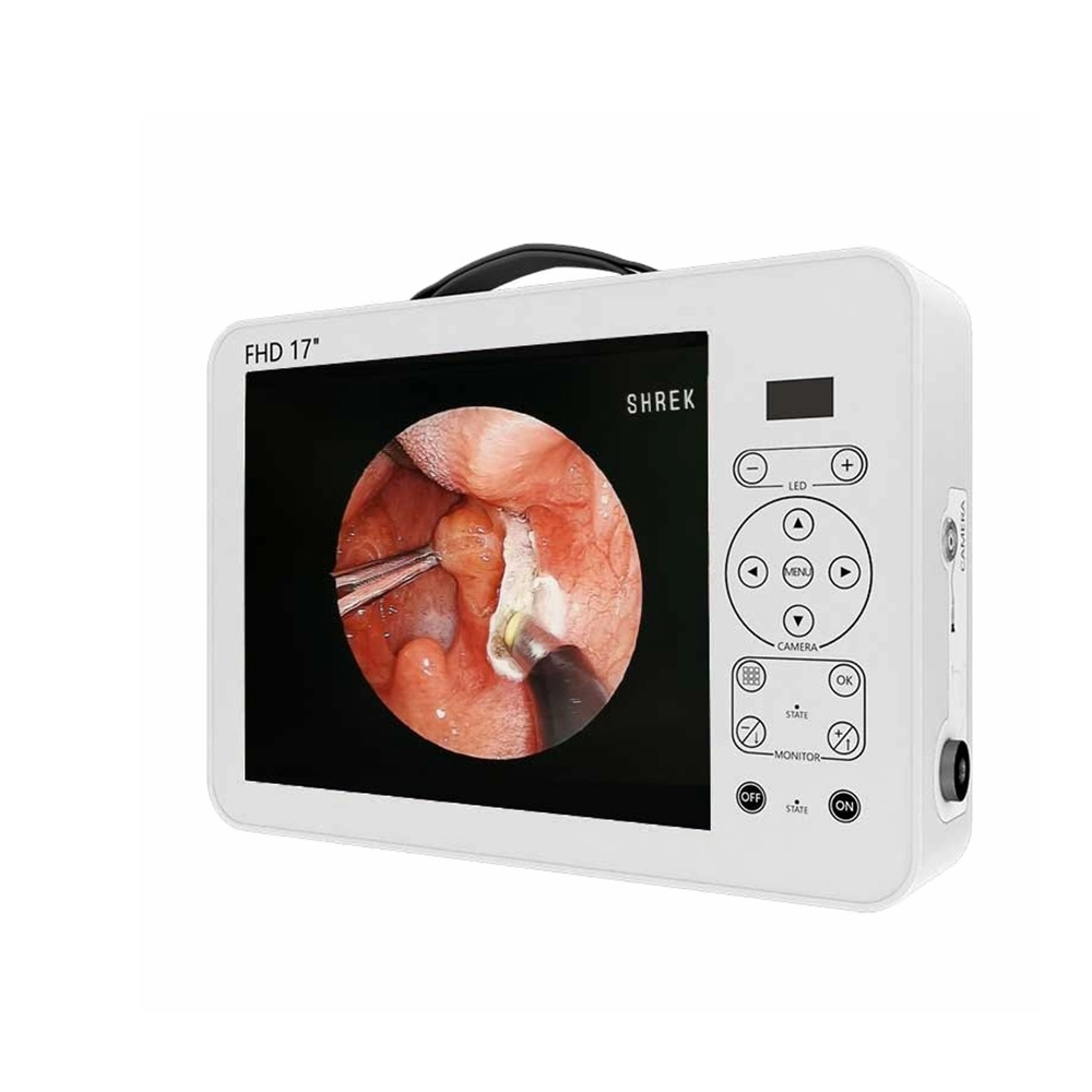 Endoscopia endoscopia de vídeo Full HD portátil de instrumentos del sistema de cámara de endoscopia de Hospital