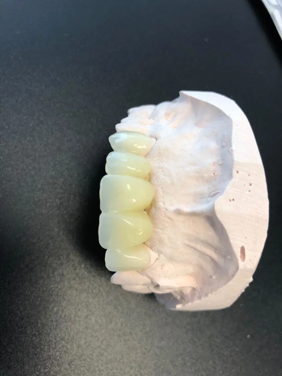 PMMA dentária PMMA Puck Bloco PMMA multicamada em branco Cad Cam Produto