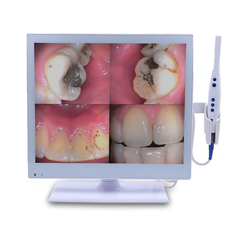 Моя-M067-1 стоматологического оборудования внутри полости рта медицинские камеры беспроводной перорального камеры стоматологической