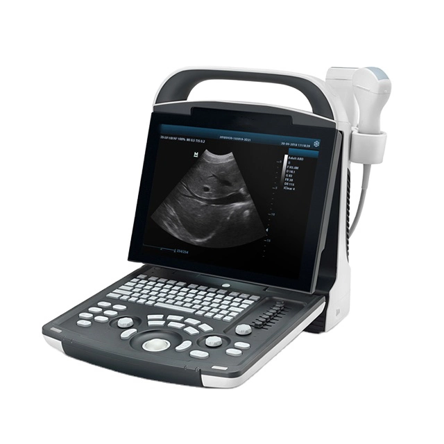 Ultrasound Device Mindray Dp 10 Vet Portable Veterinary Ultrasound