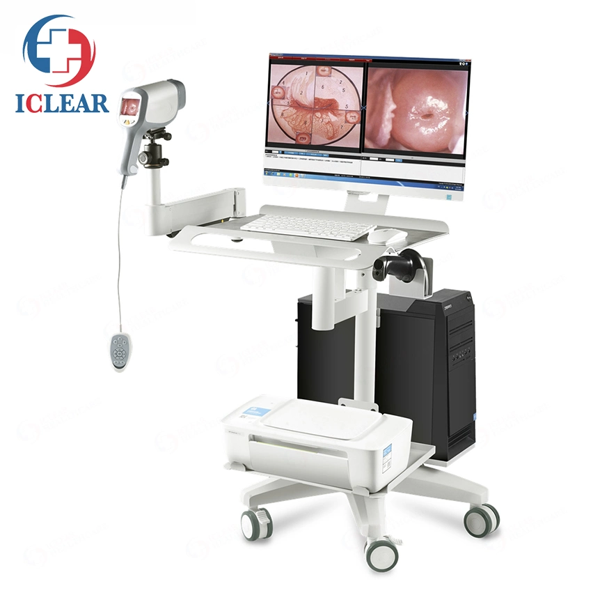 Sony CCD 2.1 Million Medical Digital HD Video Gynecology Colposcopy Equipment