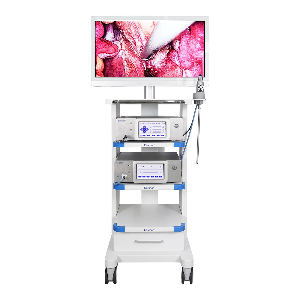 Sistema de cámara de endoscopio HD 1/2 CMOS con monitor de 27''