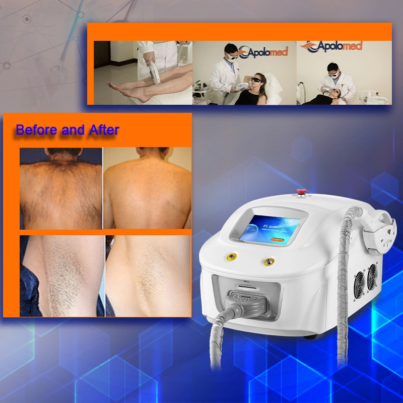 Hair Removal Beauty Skin Opt IPL Hair Loss Machine / IPL Epilator Instrument