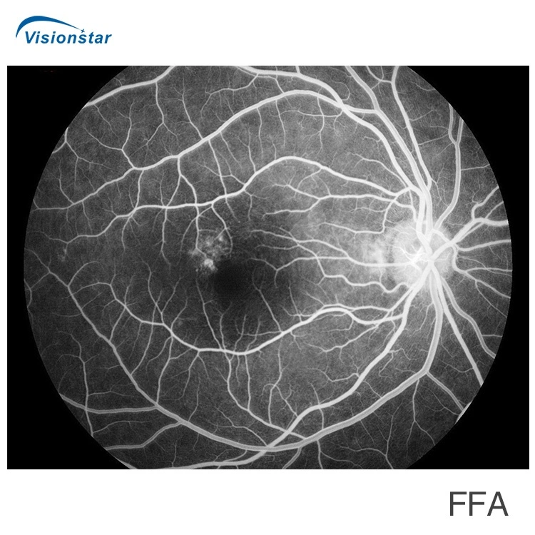 With FAF Function Non-Mydriatic Auto Focus Reticam 3100 Retinal Fundus Camera