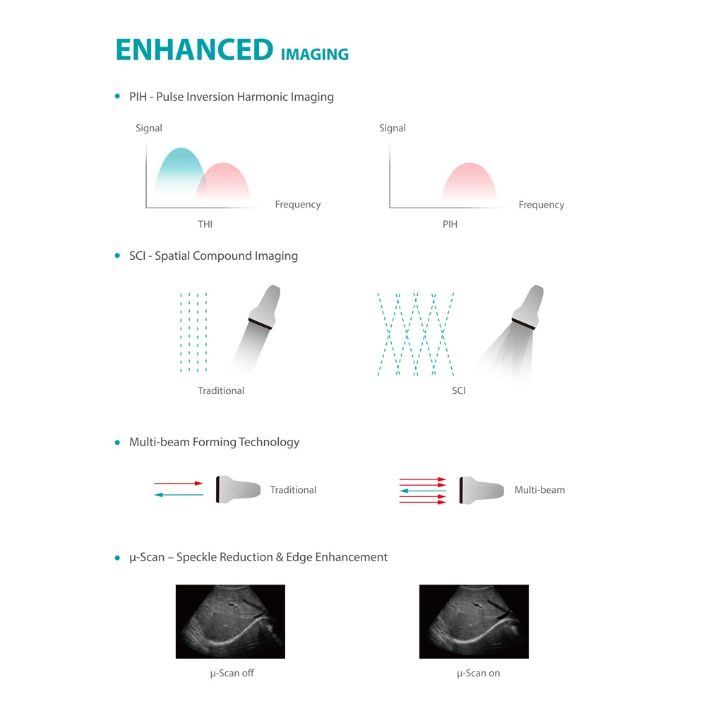 Sonoscape S11 Plus Mobile 3D/4D Color Doppler Ultrasound Scanner