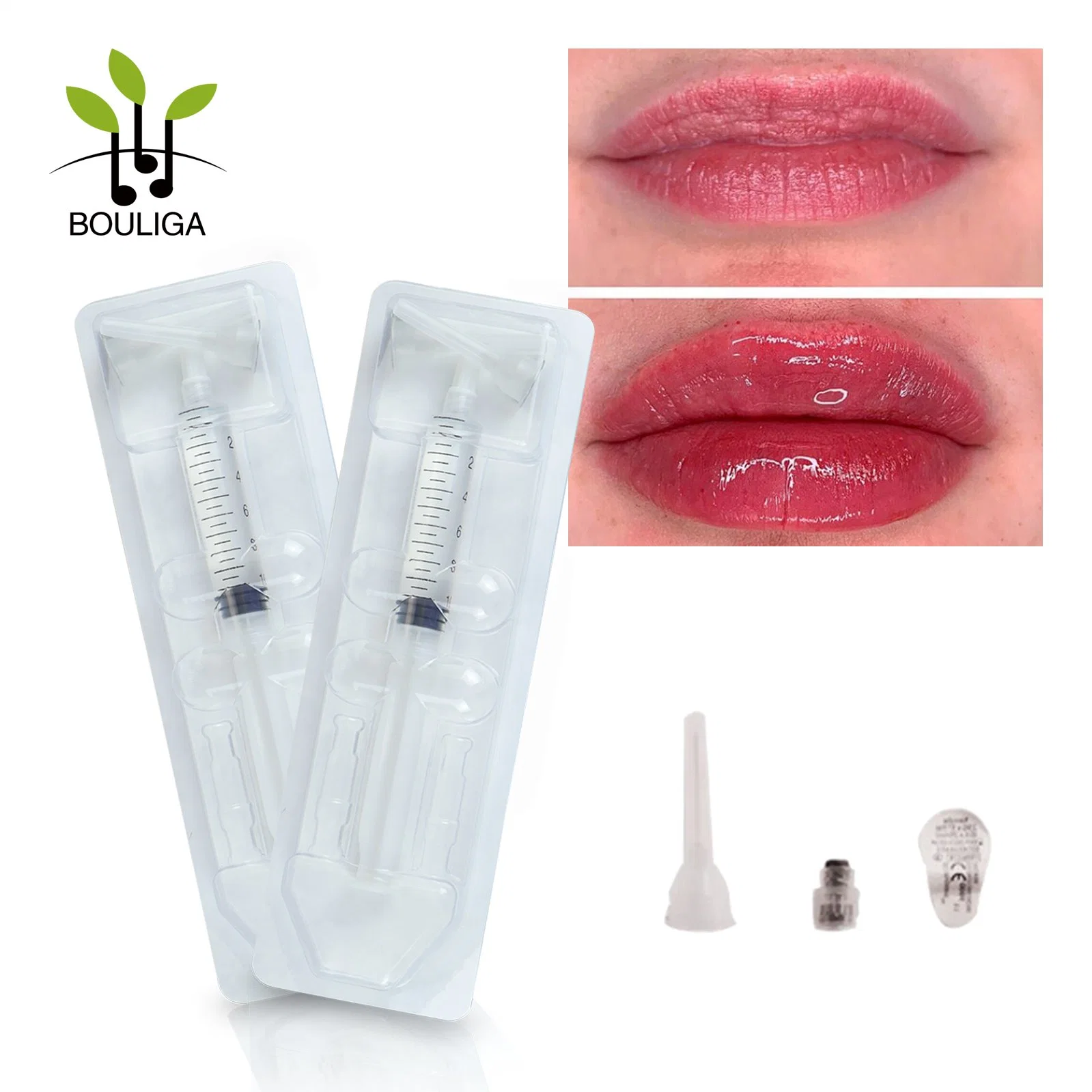 Bouliga Cross Linked Ha 10ml Recommend You Our Top-Rated Dermal Filler for Lips