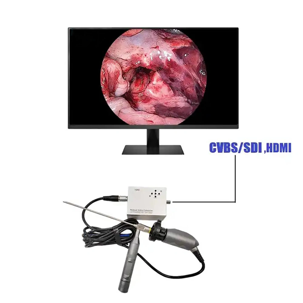 Sistema de cámara de vídeo digital digital digital de columna vertebral/extremo para endoscopia urinaria portátil ICEN USB completo HD 1080p