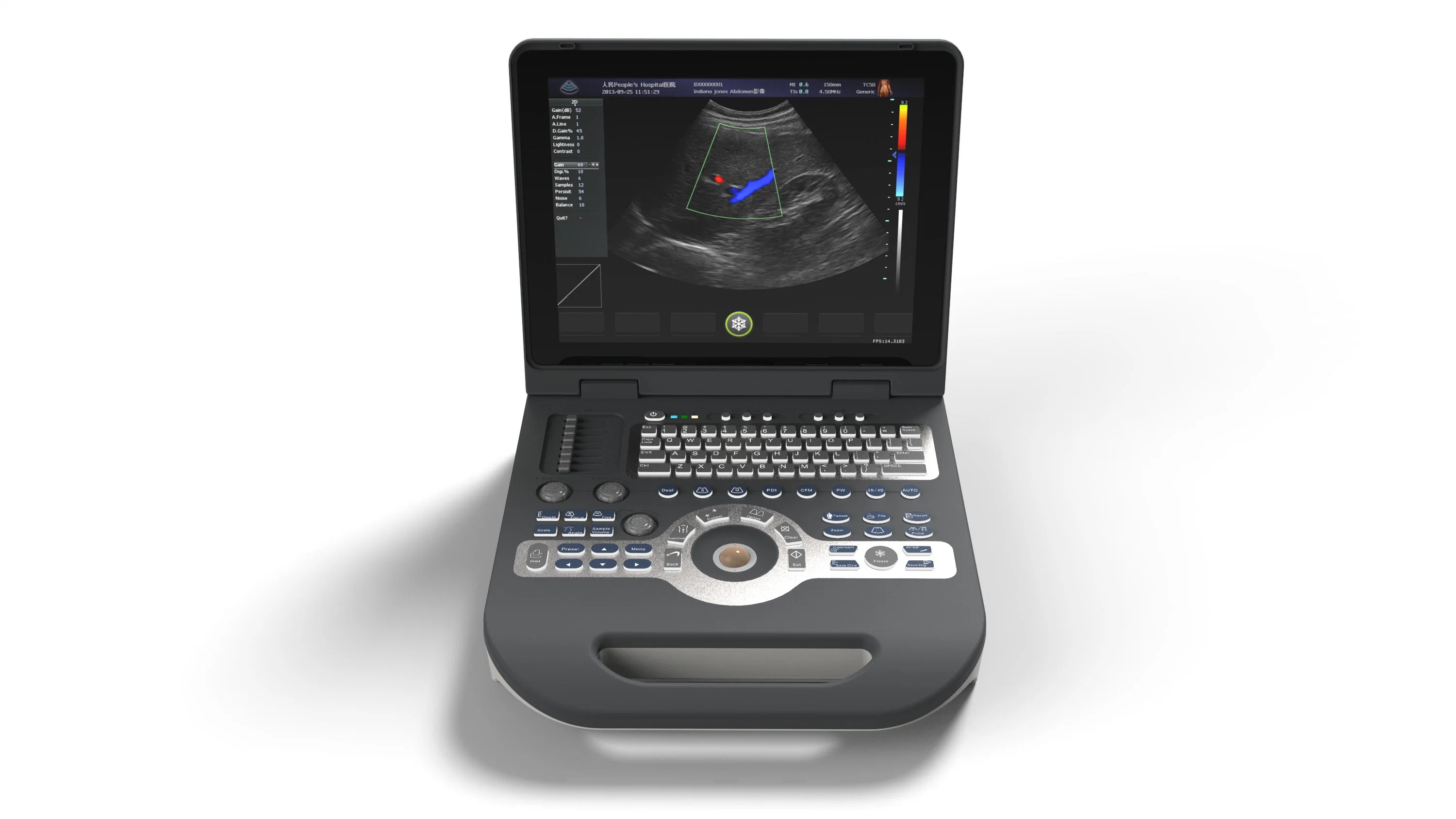 2D/3D/4D Full Digital Laptop Color Doppler Ultrasound Diagnosis System Xf3500