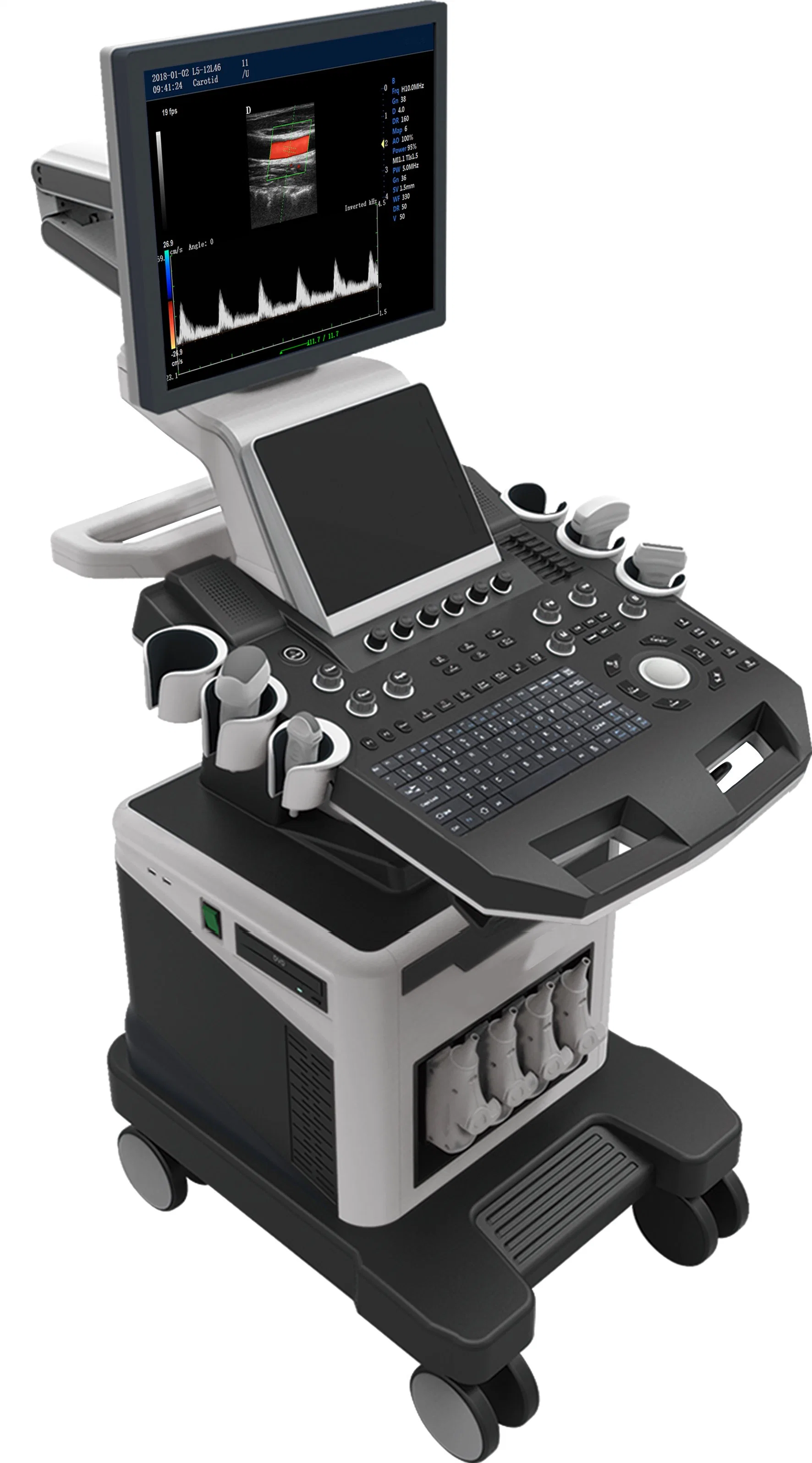 Medical Equipment Hospital Use Color Doppler Ultrasound System Portable Ultrasound Scanner