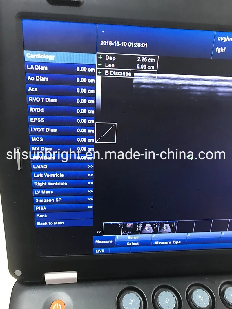 CF+B Pw Cw Function Color Doppler Ultrasound Scanner with Ce