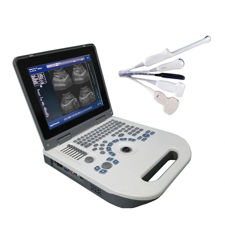 Hot Sale Portable 2D Digital Ultrasound Echo Scanner for Abdomen