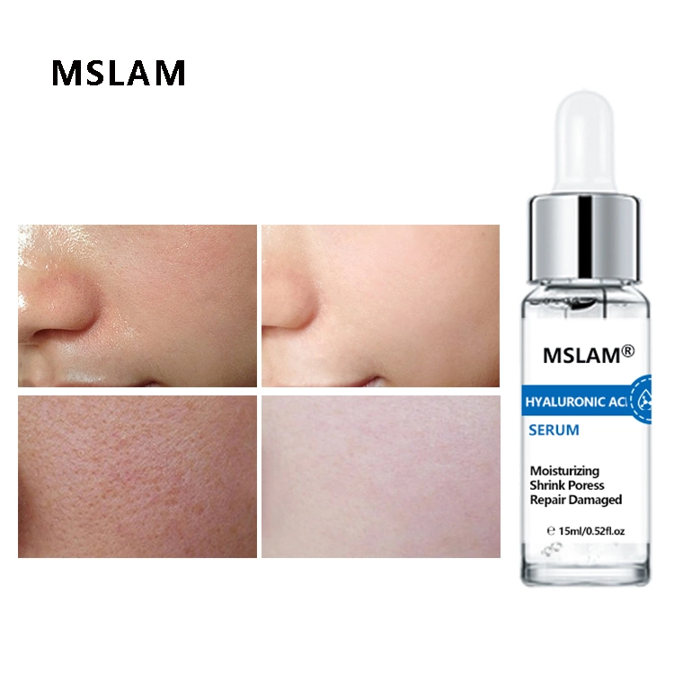 Tratamento facial com branqueamento de brilho Mslam Hydrating e tratamento facial com tratamento de pele hidratante Soro ácido hialurónico essência