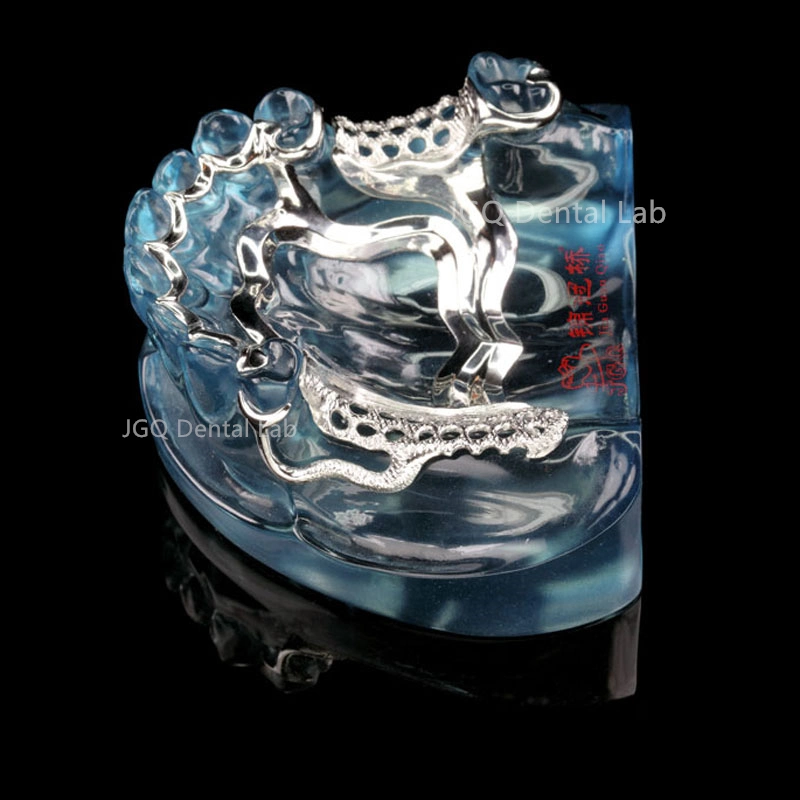 Fournitures de laboratoire dentaire de laboratoire d'implant personnalisées fournitures de laboratoire dentaire amovibles flexibles Prothèses dentaires
