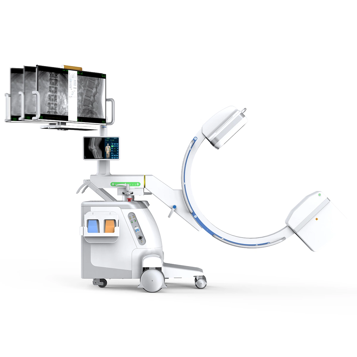 High Frequency Mobile All in One C Arm System with Fpd, Hospital Equipment for Orthopedics Urology Gynecology