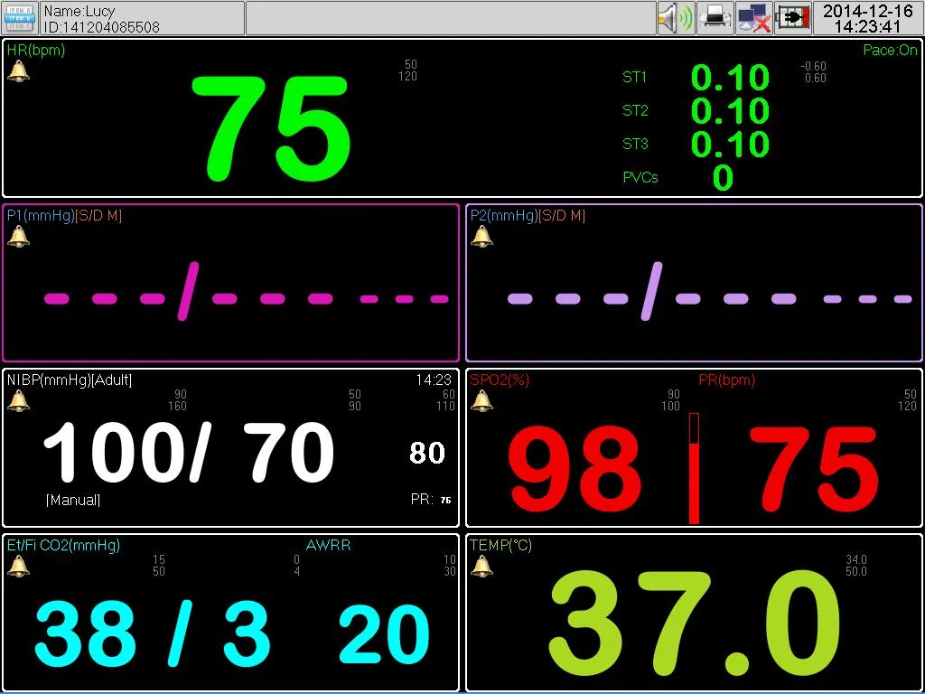 Medical Portable 15 Inch Touch Screen LCD Display Multi-Parameter Patient Monitor