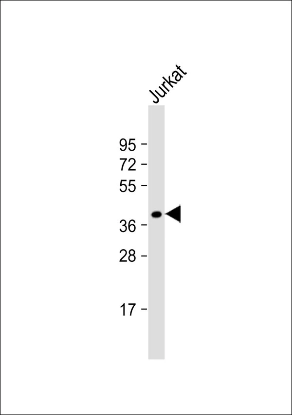 Fam84b Polyclonal Antibody