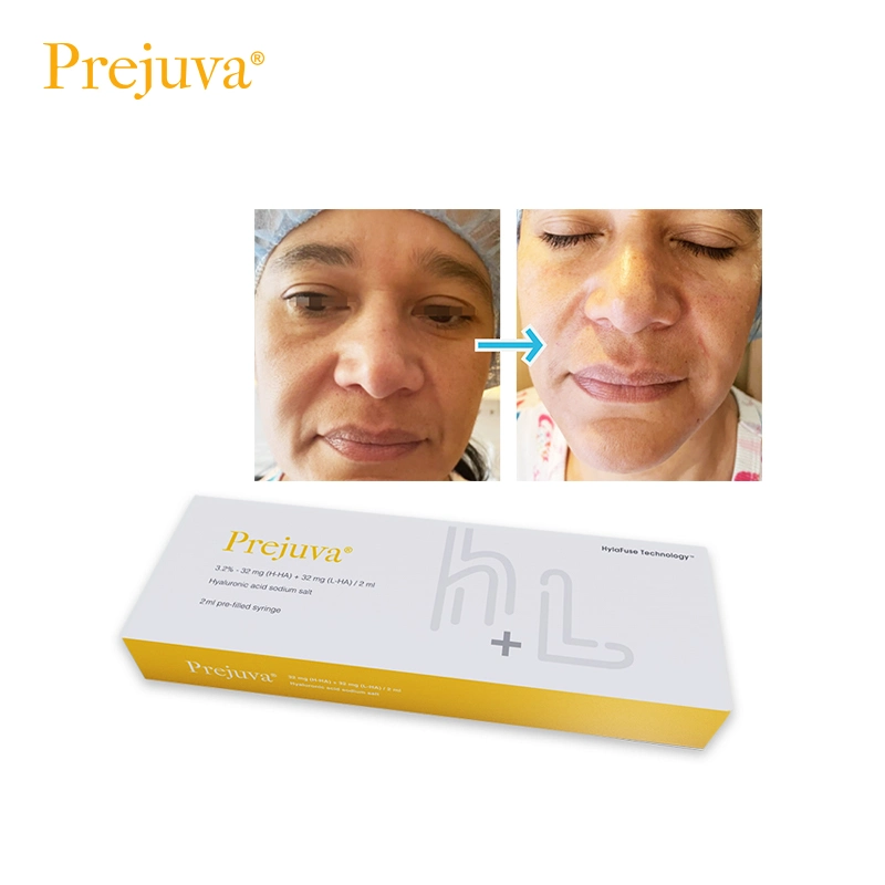 Prejuva trata de líneas finas arrugas Acide Hyaluronique Profhilo H+L 1 X 2ml Profhilo Booster para inyección de Cuerpo de piel