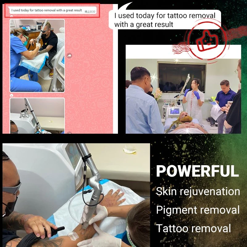 Skin Care Q-Switch Pico Laser for Tattoo/Pigment/Acne/Mole Removal Laser Beauty Salon Equipment