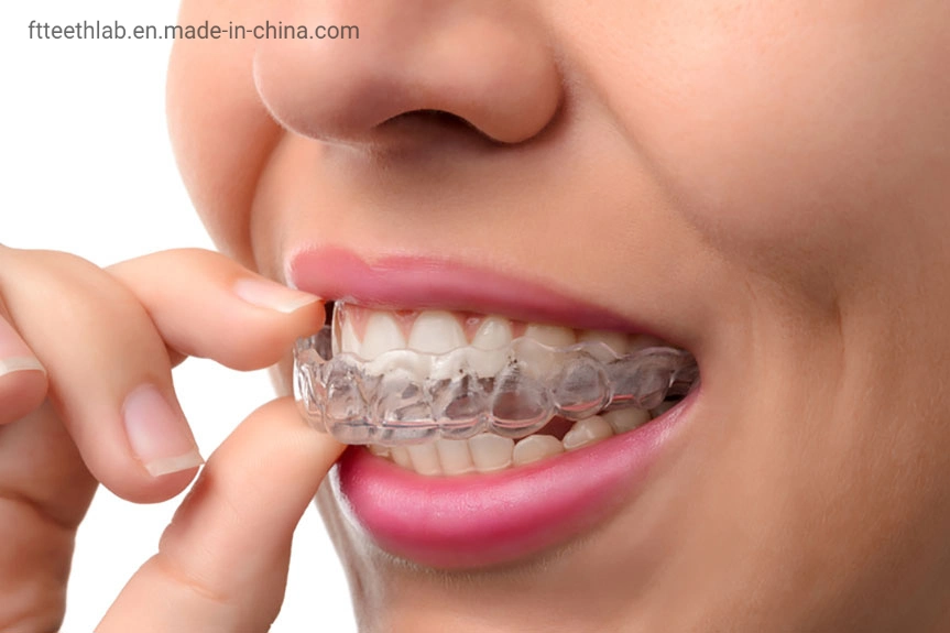 Unsichtbare orthodontische Tabletts hergestellt in China Dental Lab aus Shenzhen China, Die Ihre Unebenen Zähne Ausrichten Können