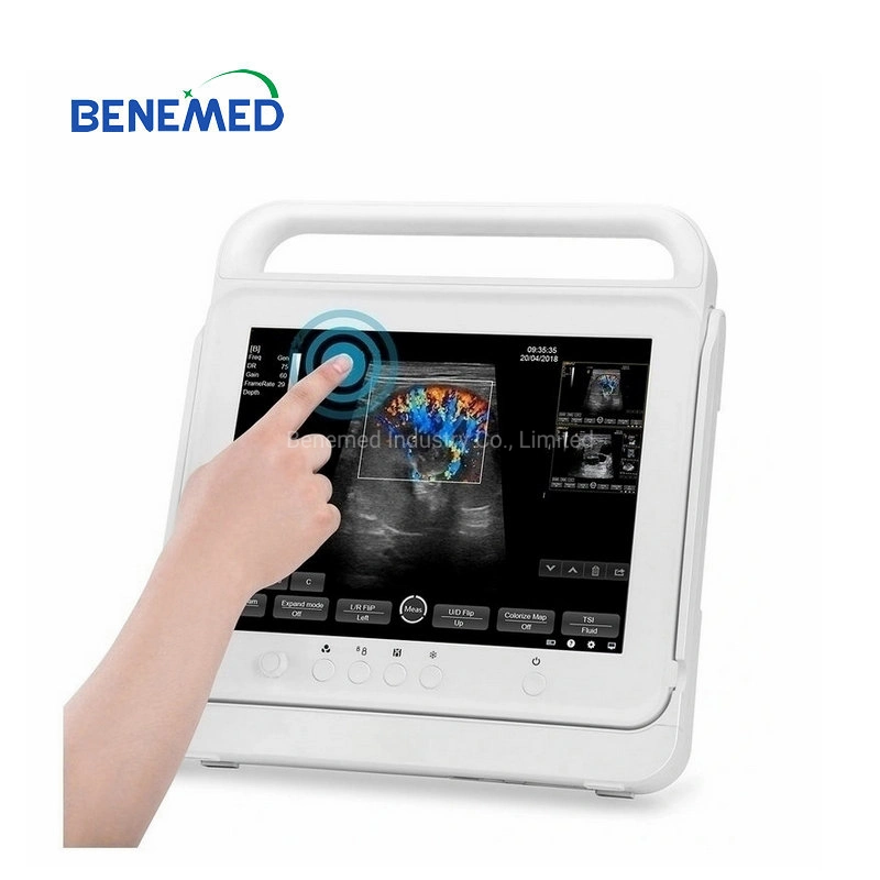 Opu Function Professional Veterinary Hand-Carried Touch Screen Ultrasound Equipment