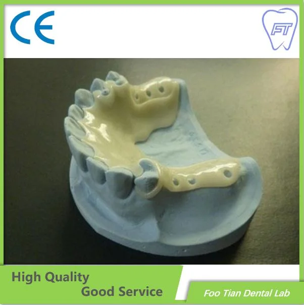 High quality/High cost performance  Removable Denture Cast Partial Framework Dental Customized