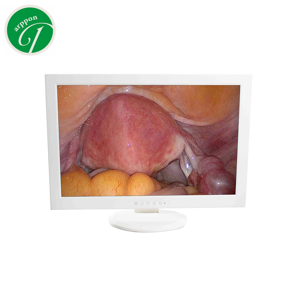 15 Inch Medical Monitor for Endoscopy Ent Hysteroscopy Arthroscopy Urology Surgery Monitor