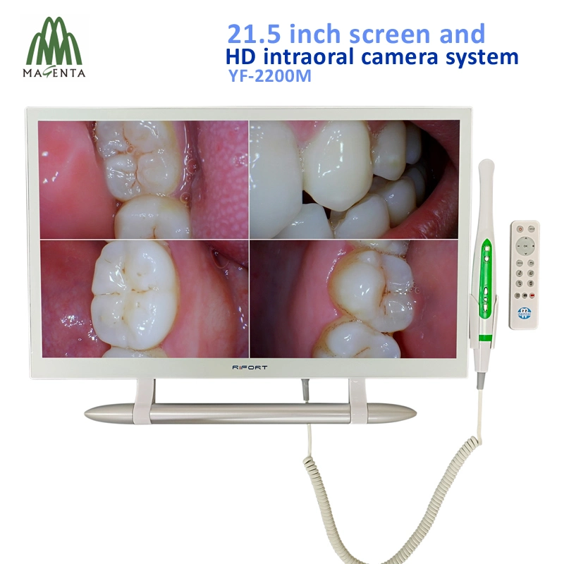 22-дюймовый стоматологическая WiFi Белый Монитор камеры полости рта Dental монитор перорального камера с разрешением VGA и HDMI