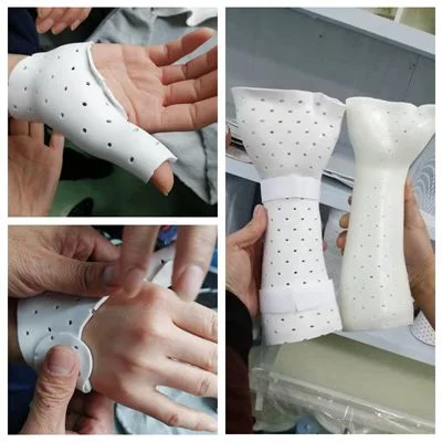 Orthopädische Thermoplastische Splintfolien Rehabilitationsfraktur Knochenimmobilisationsmaterial