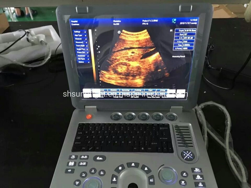 3D/4D para uso hospitalario ecógrafo portátil de ultrasonido portátil