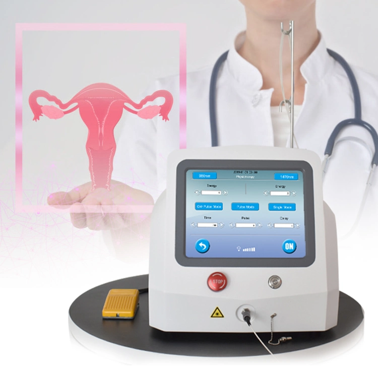 Système laser portable de chirurgie de rajeunissement et de tension vaginal 980nm 1470nm Laser à diode