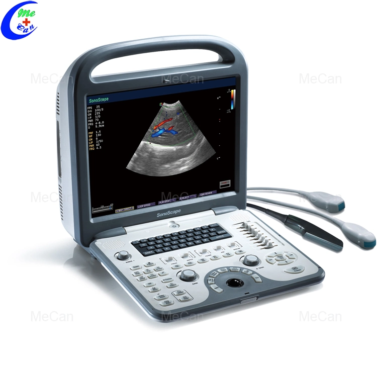 Sonoscape S6 Cardiac 4D Color Doppler Echo Ultrasound Machine with Pw Cw