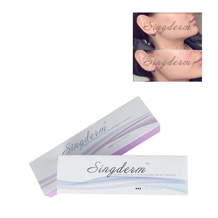 Singderm Injection d'acide hyaluronique Remplisseur dermique avec 0,3% de Lidoca! Ne Cosmetics Remplisseur esthétique pour la chirurgie plastique.