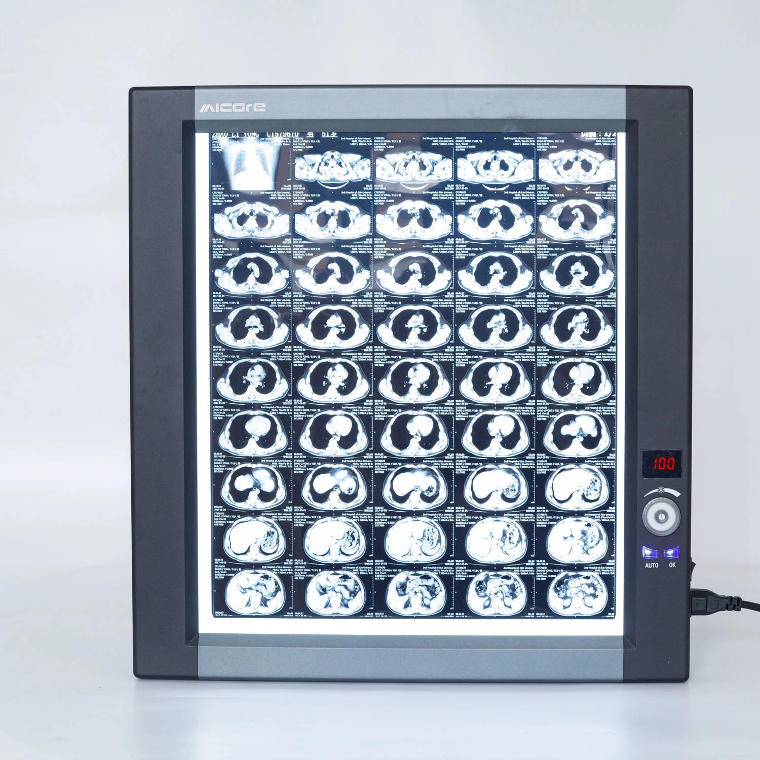 LED Viewing Box, X Ray Viewer, Negatoscope, Medical Film Viewer Double Screen Zg-3c