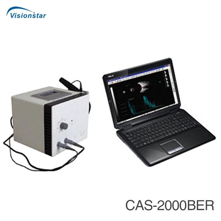 CE scanner à ultrasons ophtalmique approuvé, a/b, Ab de numérisation du scanner