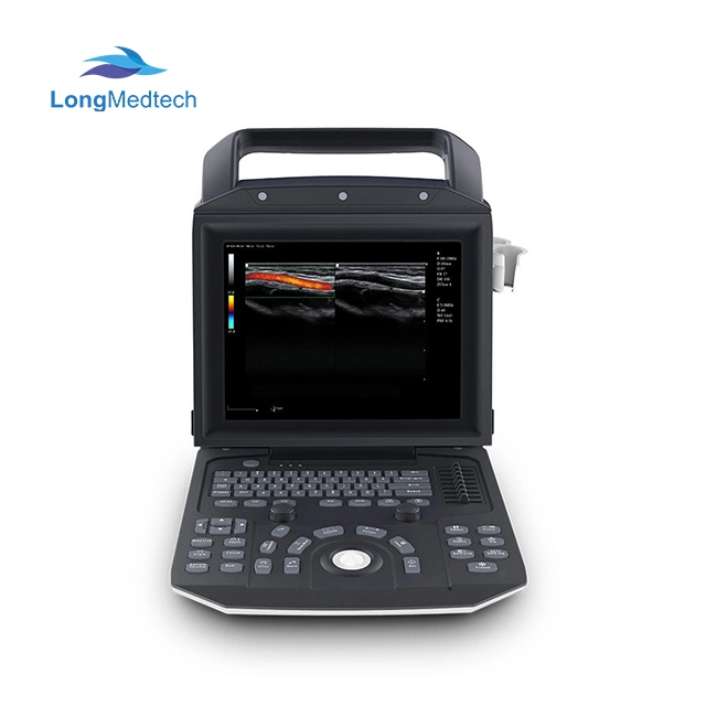 Portable Zoncare M5 Medical Ultrasonic Equipment Full Digital Vet B/ M/ B/M Diagnostic Color Doppler Ultrasound