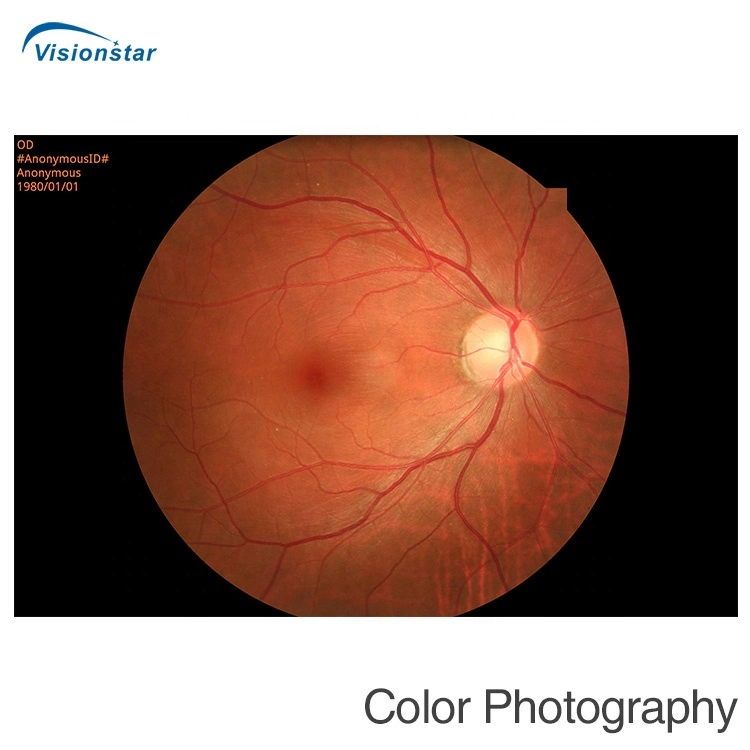 With FAF Function Non-Mydriatic Auto Focus Reticam 3100 Retinal Fundus Camera