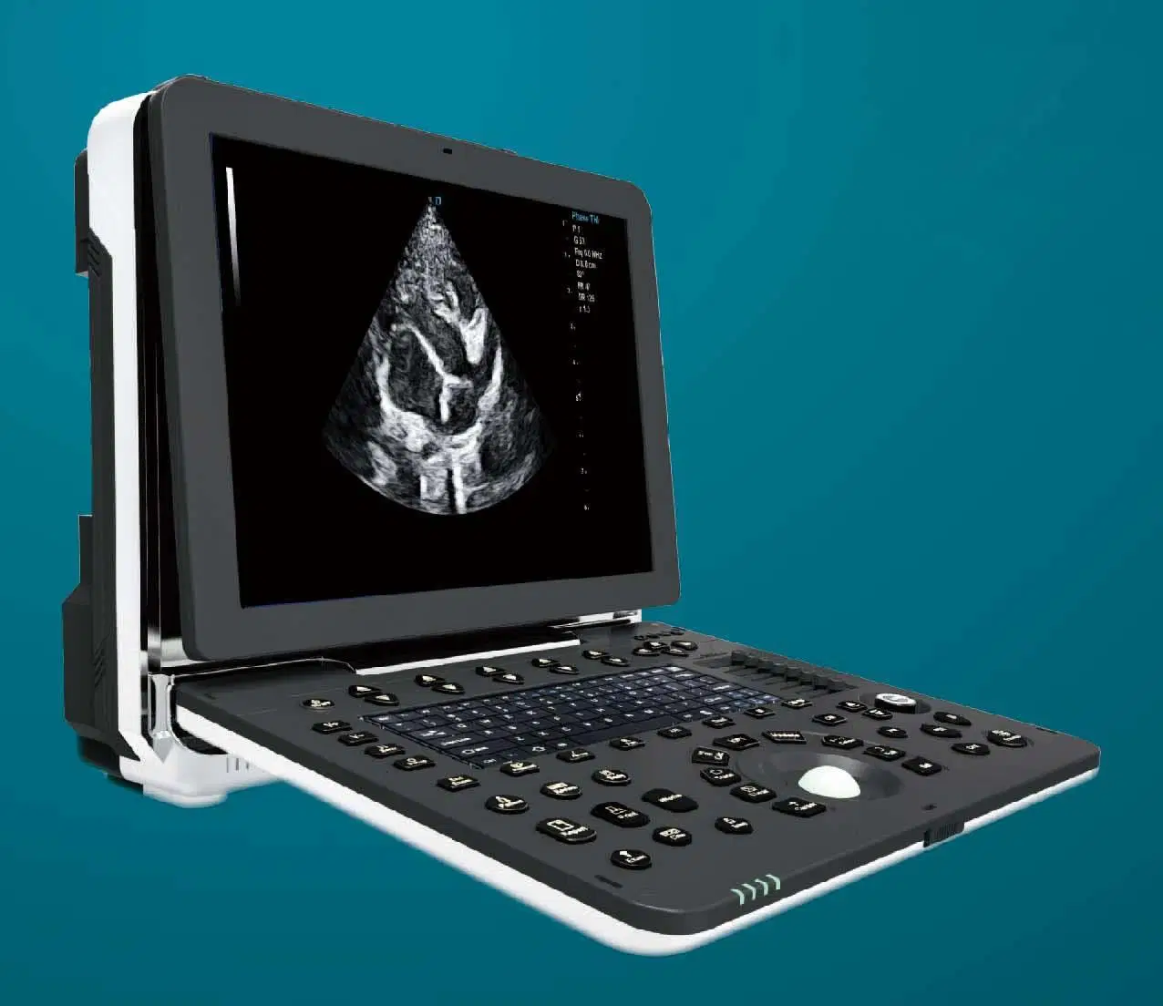 Portable Full Digital Color Doppler Veterinary Ultrasound Diagnostic Scanner